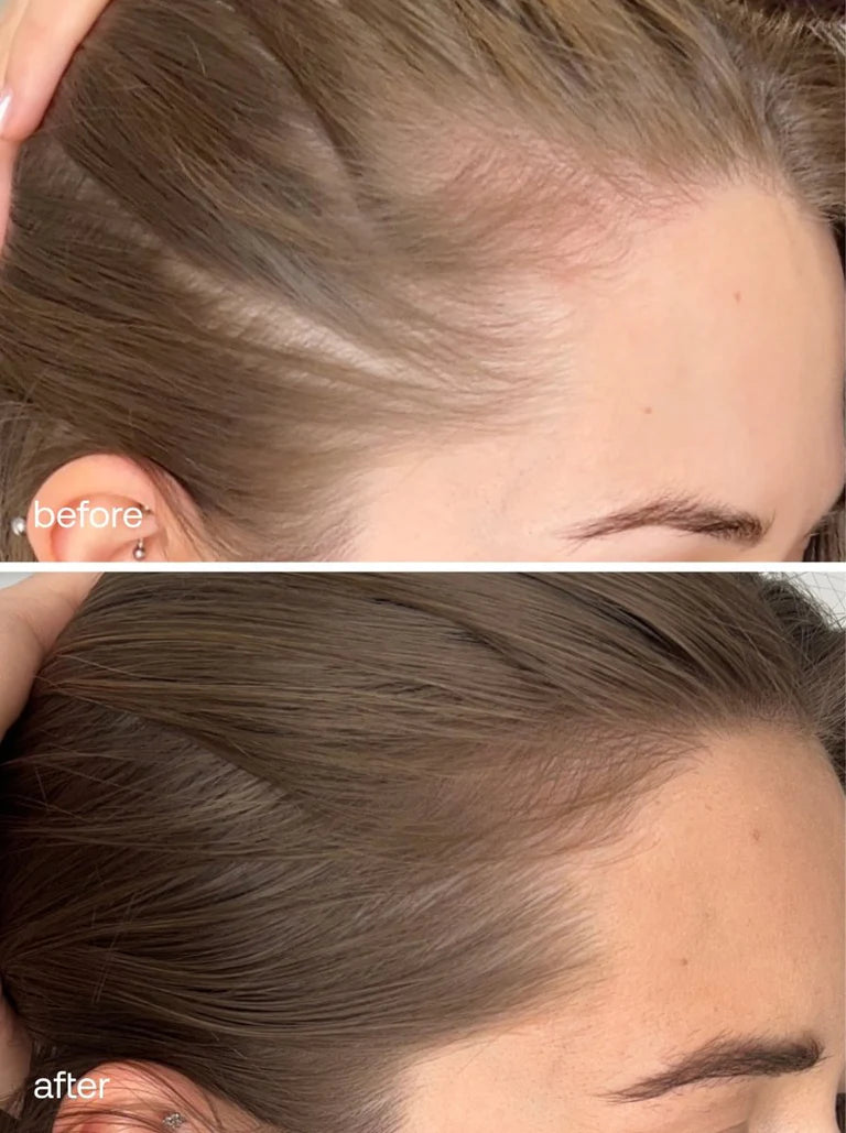 Advanced Hair Supplements